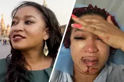 Black woman who left US for Russia to escape ‘discrimination’ is beaten by racist neighbors